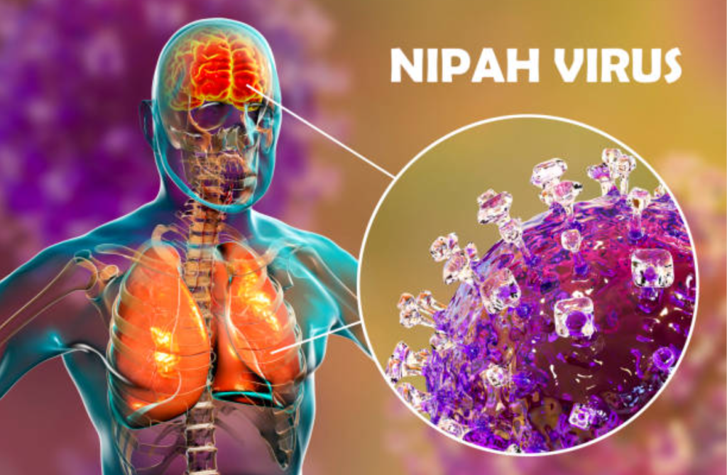 Nipah Virus in Kerala